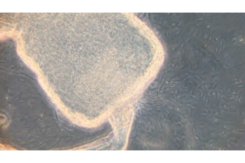 parasites that cause leishmaniasis coming out of a sand fly's gut, where they live
