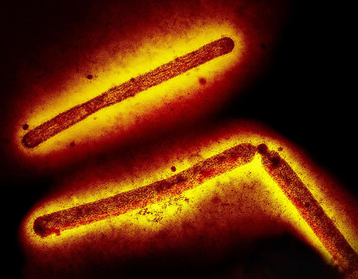 Three influenza A (H5N1/bird flu) virus particles (rod-shaped)