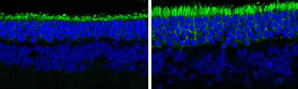 Rod photoreceptors are immunostained with REEP6 (green). Rod photoreceptor inner segments are shorter in the control-treated rats (left) compared with those treated with reserpine (right).