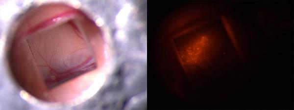 a window in the skull of a mouse gives a view of fluorescent neurons in its brain